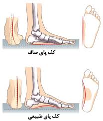 صافی کف پا را چطور تشخیص دهیم ؟