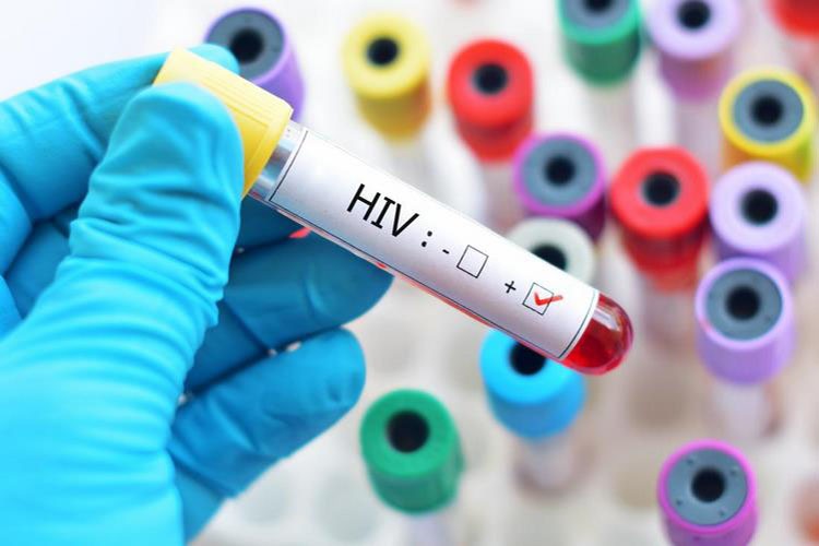 آمادگی مراکز جامع سلامت دزفول برای نمونه گیری HIV